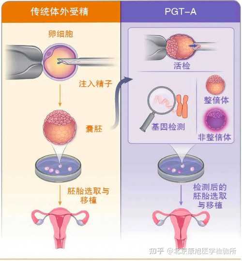 精子畸形率高试管